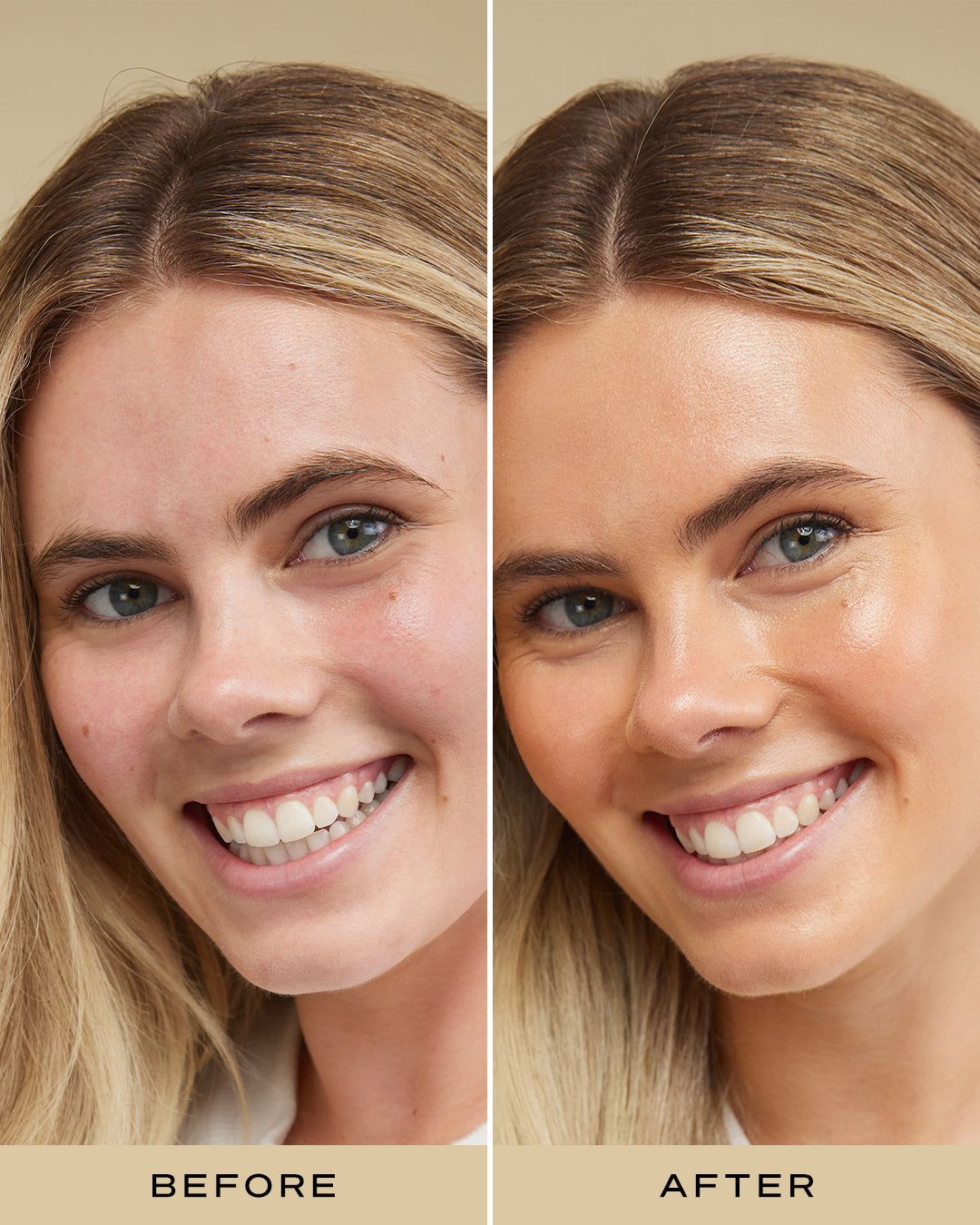 BBB CREAM SPF 30+ DARK b&a